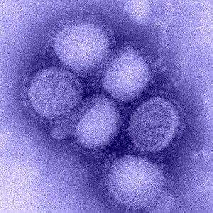 Photo of the H1N1 virus