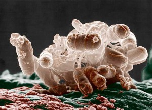 Colorized low-temperature electron micrograph of a cluster of E. coli bacteria. Photo by Eric Erbe, Colorization by Christopher Pooley. USDA