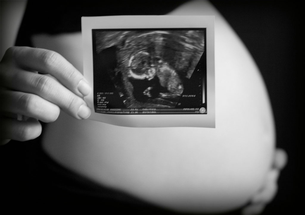 Pregnant woman. Photo by Trevor Bair