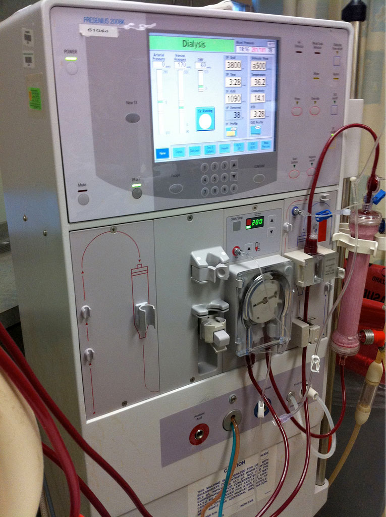 Fresenius backs out of dialysis deal with Fletcher Allen Health Care