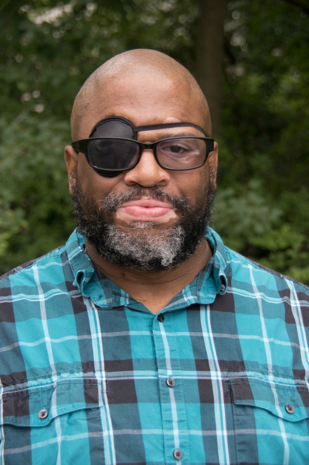 Duane Dunston