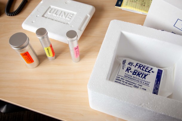 coronavirus test specimen containers