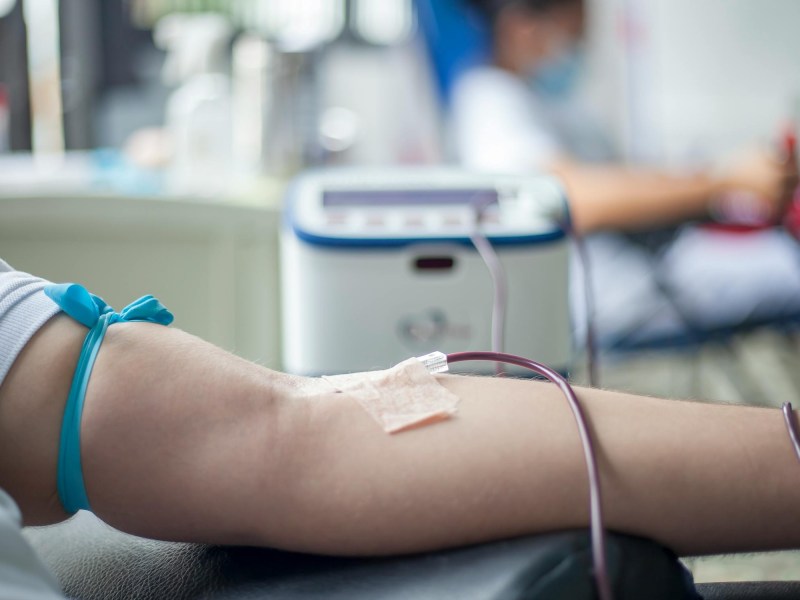 Close-up of a person's arm donating blood with a needle inserted, tube connected to a machine. Background shows another person donating blood.